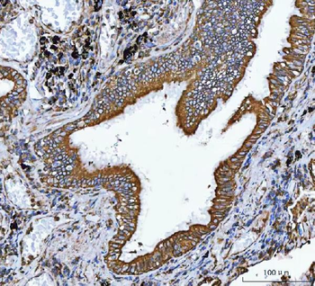 VAPA Antibody