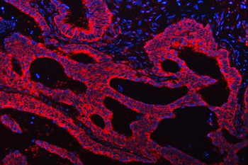 TRMT61B Antibody