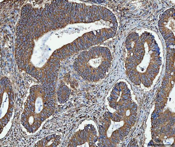 TRMT61B Antibody