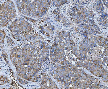 TRMT61B Antibody