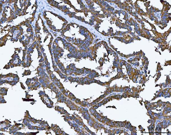 TRMT61B Antibody