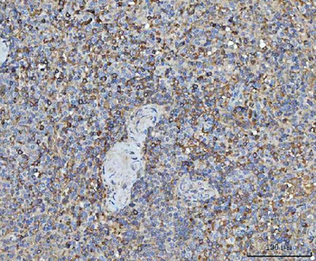 TRMT61B Antibody