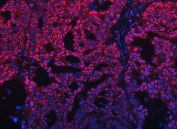 TRMT10C Antibody