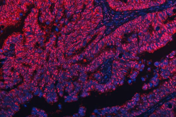TRMT10C Antibody