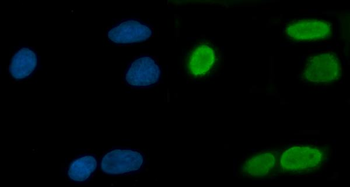 TRMT10C Antibody