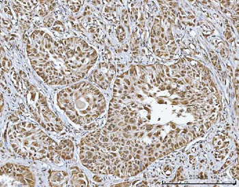 TRMT10C Antibody