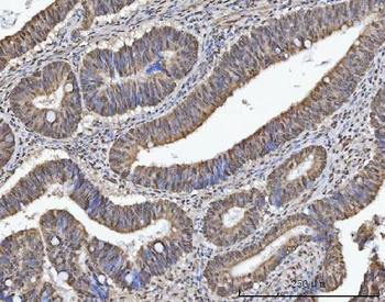 TRMT10C Antibody