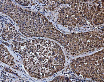 TRMT10C Antibody