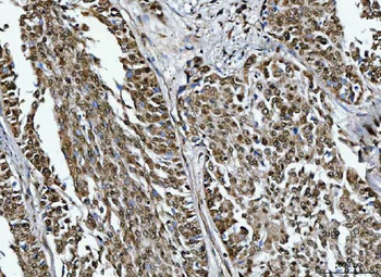 TRMT10C Antibody