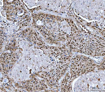 TRMT10C Antibody