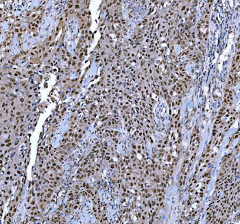 TRMT6 Antibody