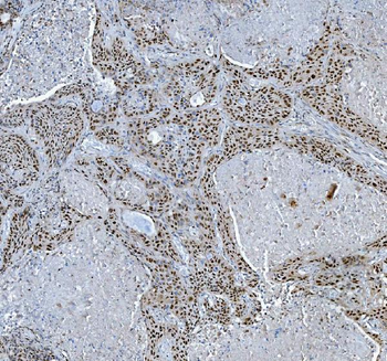 TRMT6 Antibody