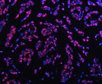 TRMT6 Antibody