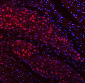 TRMT6 Antibody