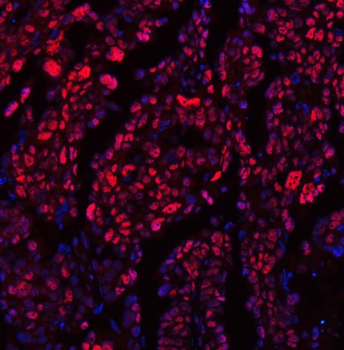 TRMT6 Antibody