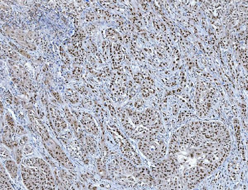TRMT6 Antibody