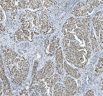 TRMT6 Antibody