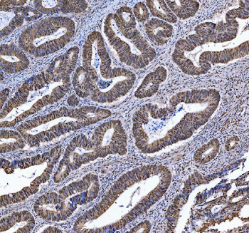 TRMT6 Antibody