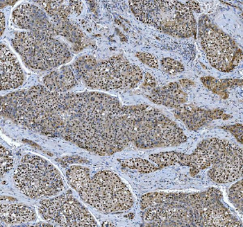 TRMT6 Antibody