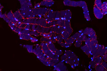 MG53/TRIM72 Rabbit Polyclonal Antibody