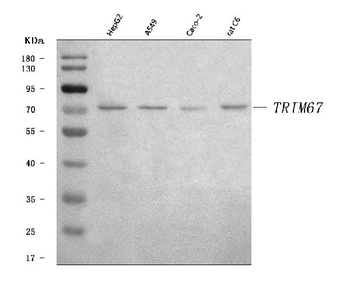TRIM67 Rabbit Polyclonal Antibody