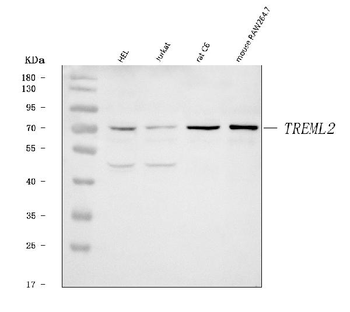 TREML2 Rabbit Polyclonal Antibody