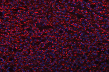 TRANK1 Antibody