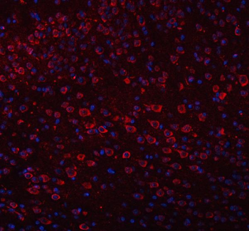 TRANK1 Antibody
