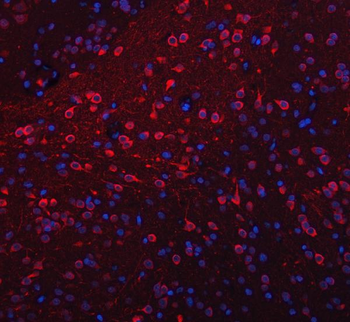 TRANK1 Antibody
