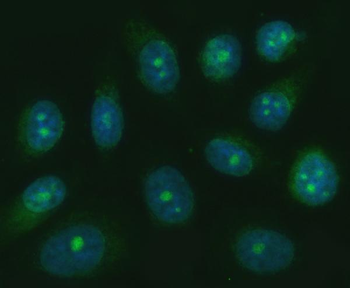 TRANK1 Antibody
