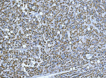 TRANK1 Antibody