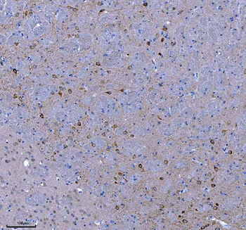 TRANK1 Antibody