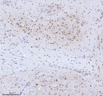 TRANK1 Antibody
