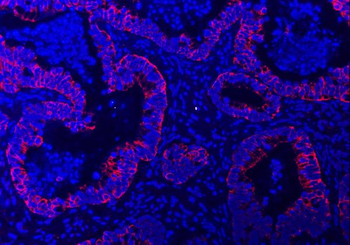 TRAM1L1 Rabbit Polyclonal Antibody