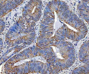 TRAM1L1 Rabbit Polyclonal Antibody