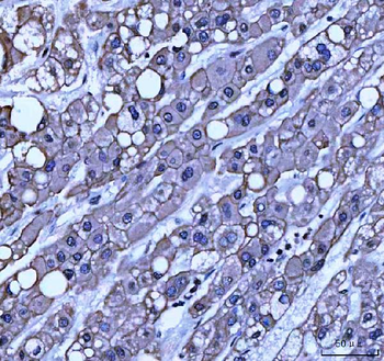 TRAM1L1 Rabbit Polyclonal Antibody