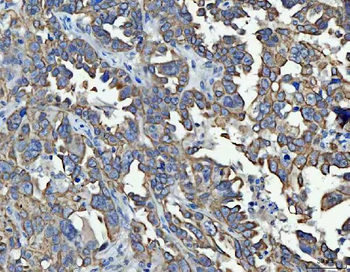TRAM1L1 Rabbit Polyclonal Antibody