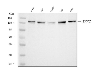 Tripeptidyl peptidase II/TPPII/TPP2 Rabbit Polyclonal Antibody