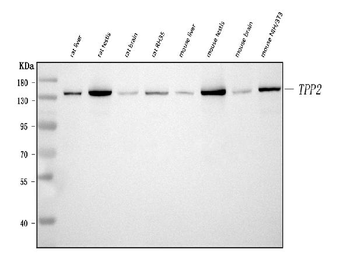 Tripeptidyl peptidase II/TPPII/TPP2 Rabbit Polyclonal Antibody