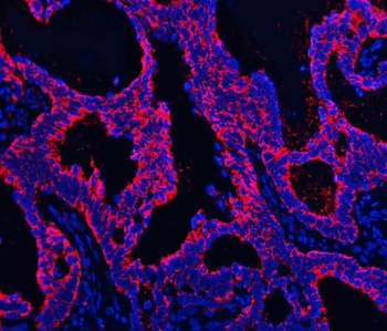 TMPRSS13 Antibody