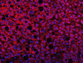 TMPRSS13 Antibody