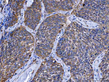 TMPRSS13 Antibody