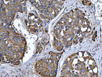 TMPRSS13 Antibody