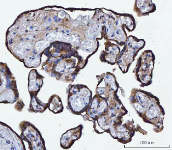 TMPRSS13 Antibody