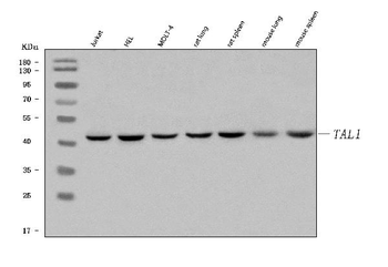 TAL1 Rabbit Polyclonal Antibody