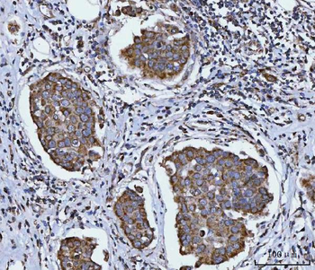 SIRT5 Rabbit Polyclonal Antibody