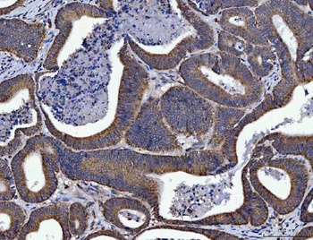 SIRT5 Rabbit Polyclonal Antibody