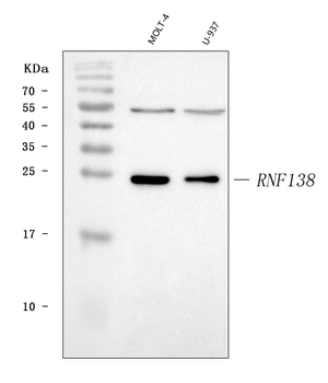 HSD-4/RNF138/HSD Rabbit Polyclonal Antibody