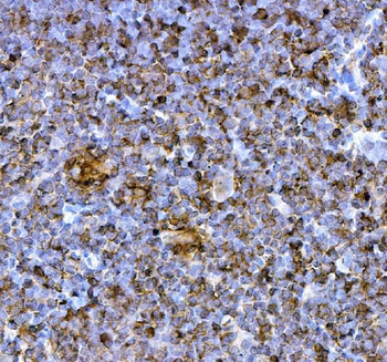 PD1/Pdcd1 Antibody