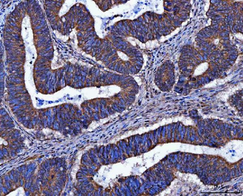 FRY Antibody